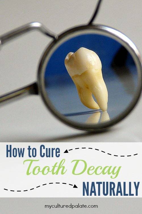 Cure Tooth Decay Naturally