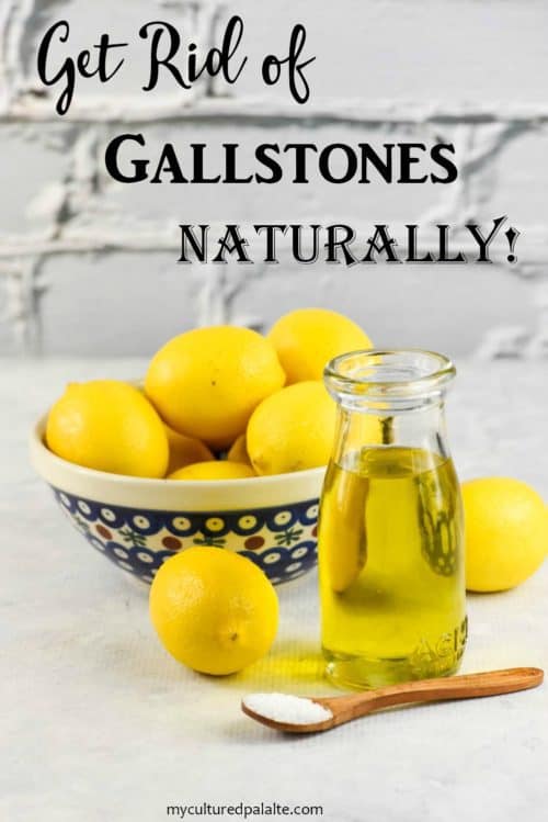 How to get rid store of gallstones