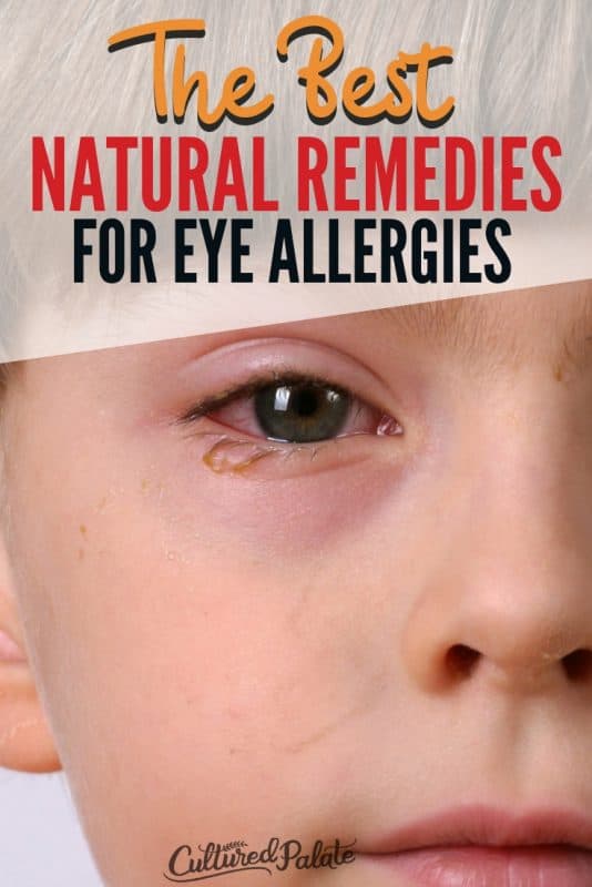 Natural Remedies For Eye Allergies Cultured Palate